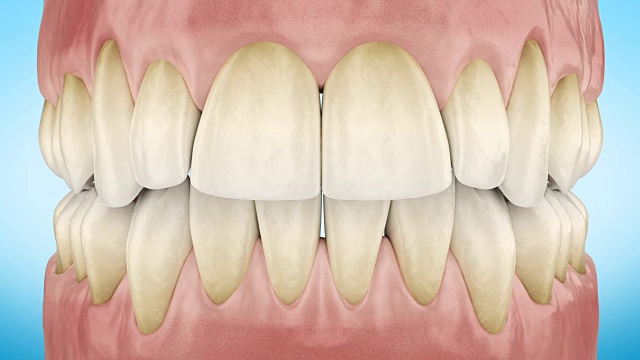 肮脏的黄色牙齿放大3d动画。阿尔法通道。