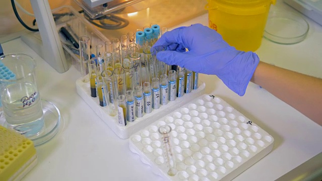 科学家在实验室烧瓶中分析病毒。