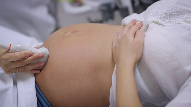孕妇在做超声波检查。全高清视频