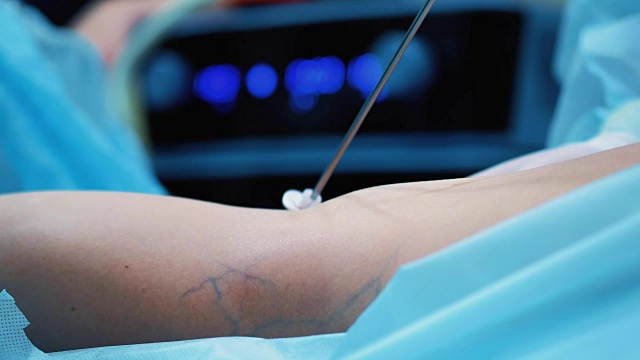 手术室:抽脂手术准备。一组外科医生给一个女孩做抽脂手术。外科医生的工作就像插管。