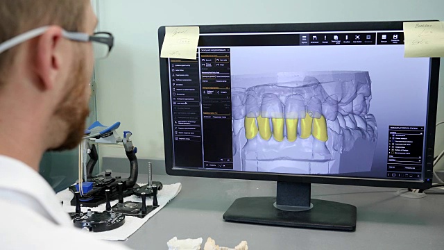 现代牙科，牙齿矫正师在电脑上制作颌骨的3d模型