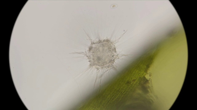 在显微镜下观察最简单的日虫纲生物，类似放射虫