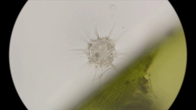 详情图-在显微镜下观察最简单的日虫纲生物,类似放射虫