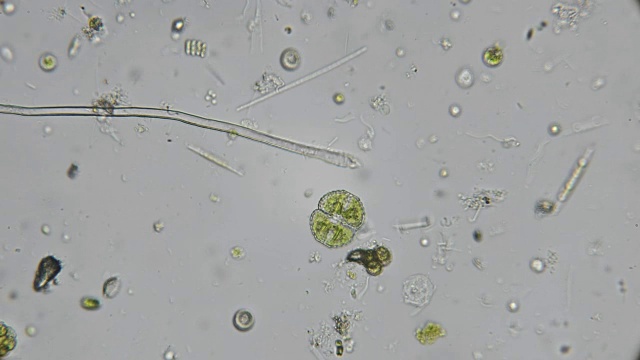 在显微镜下从肮脏池塘中滴下的一滴水，有许多微生物，包括寄生虫，如木棍和螺旋体