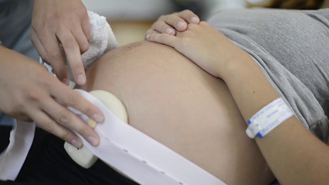 孕妇正在接受宫缩监测和静脉注射。