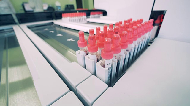 带血的管子放在特制的实验室机器上准备检查。