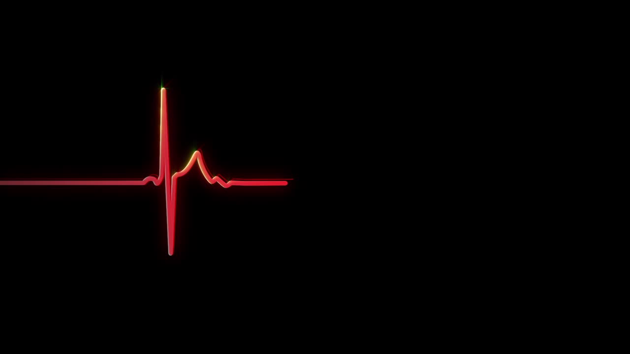 ECG/EKG |脉搏追踪